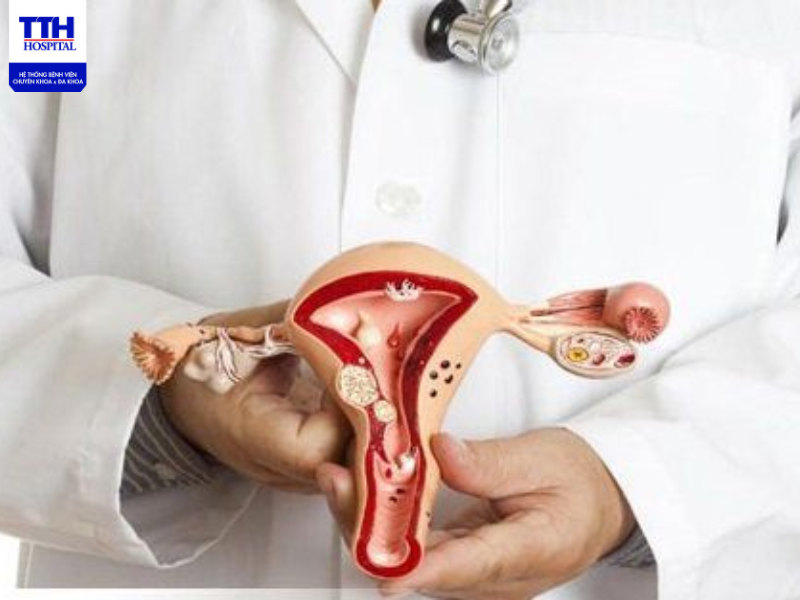 NHỮNG ĐIỀU CẦN BIẾT VÀ PHƯƠNG PHÁP ĐIỀU TRỊ BỆNH POLYP CỔ TỬ CUNG